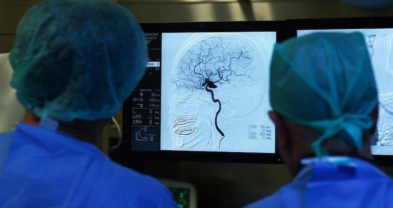 Kolesterol seviyesi sabit olmayan kişilerin demans riski daha yüksek